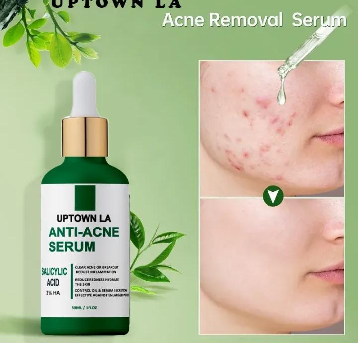 UPTOWN LA Anti Acne serum