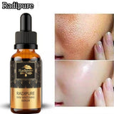 Radipure 5 in Skin whittining & glowing serum