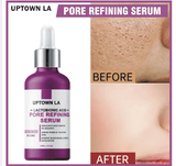 UPTOWN LA PORE REFINING Serum 30 ML