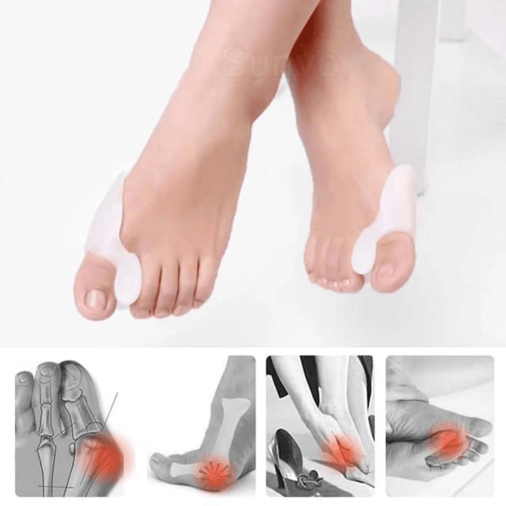 Sunvo Silicone Gel Bunion Protector & Toe Straightener (1 Pair)