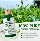 UPTOWN LA Anti Acne serum 30 ml