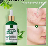 UPTOWN LA Anti Acne serum