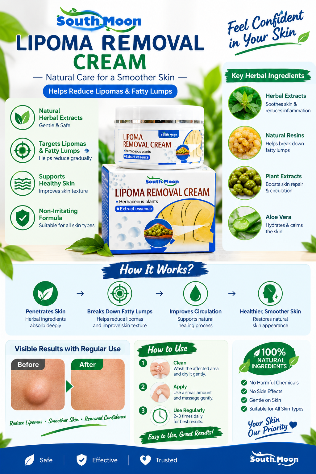 South Moon Lipoma Removal Cream – Herbal Extract Skin Care Cream